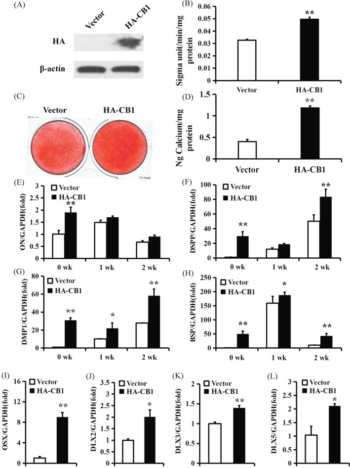 Overexpression of CB1 enhanced the osteo/dentinogenic differentiation of PDLSCs. (A) Western blot results showed the overexpression efficiency of HA‐CB1 in PDLSCs. β‐actin was used as an internal control. (B) ALP activity assay. (C) Alizarin Red staining. (D) Calcium quantitative analysis. (E‐H) Real‐time RT‐PCR results of the ON (E), DSPP (F), DMP1 (G) and BSP (H) expression levels during PDLSC osteo/dentinogenic differentiation. (I‐L) Real‐time RT‐PCR results of OSX (I), DLX2 (J), DLX3 (K) and DLX5 (L) expression levels in PDLSCs. GAPDH was used as an internal control. Student's t test was performed to determine statistical significance. Error bars represent the SD (n = 3). *P ≤ .05; **P ≤ .01