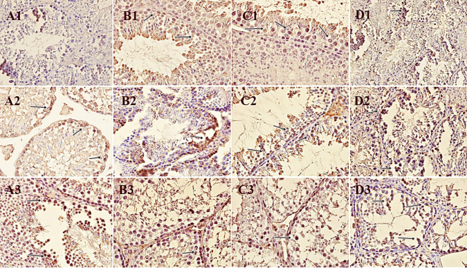 Immunopositivity of the testicles of experimental groups for different markers (arrows). A Control group, B CAD group, C CAD + SA group, D SA group, (1) iNOS, (2) cyclinD1, (3) CB1. iNOS: control showed no findings, SA showed low positivity in some apoptotic cells, CAD showed mild positivity in apoptotic and necrotic cell lining in seminiferous tubules, CAD + SA showed moderate positivity in apoptotic cells with karyopyknosis in many fields. Cyclin D1: control showed moderate positivity in cell lining seminiferous tubules; SA showed mild positivity in some cells; CAD showed low positivity in apoptotic and necrotic cell lining seminiferous tubules; CAD + SA showed moderate positivity in apoptotic cells; CB1: control showed mild positivity in cell lining seminiferous tubules; SA showed moderate positivity in some cells; CAD showed low positivity in apoptotic and necrotic cell lining seminiferous tubules; CAD + SA showed low positivity in apoptotic and degenerated cells in seminiferous tubules. Strept ABC. DAB chromogen and counterstaining with Mayer’s hematoxylin (20 × objective)