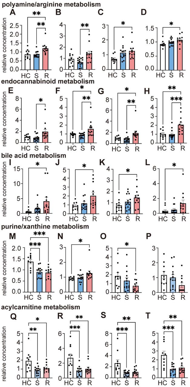Differences in metabolic pathways among patients with rapidly progressive ALS, patients with slowly progressive ALS, and healthy individualsSerum levels of representative metabolites in the pathways we focused on were compared among Rapid ALS patients, Slow ALS patients, and healthy individuals. (A–D) Polyamine/arginine metabolism (A, (N(1) + N(8))-acetylspermidine; B, spermidine; C, pro-hydroxy-pro; D, dimethylarginine), (E–H) endocannabinoid metabolism (E, N-oleoyl taurine; F, N-stearoyl taurine; G, N-linoleoyl taurine; H, N-palmitoyl taurine), (I–L) bile acid metabolism (I, cholate; J, hyocholate; K, chenodeoxycholate; L, 7-ketodeoxycholate). (M–P) purine/xanthine metabolism (M, adenine; N, xanthine; O, 1,3-demethylurate; P, 3,7-dimethylurate), (Q–T) acylcarnitine metabolism (Q, cis-4-decenoylcarnitine; R, 5-dodecenoylcarnitine; S, decanoylcarnitine; T, laurylcarnitine). Data information One-way ANOVA and Tukey’s post hoc analysis were performed (*p < 0.05, **p < 0.01 and ***p < 0.001). HC, healthy controls; R, Rapid ALS; S, Slow ALS. Error bars indicate the SEM.