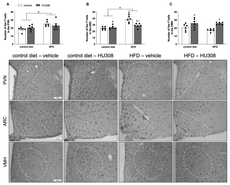 Effect of prolonged icv infusion of vehicle or HU308 for 2 weeks on the number of Iba-1+ cells in the paraventricular (PVN), arcuate (ARC) and ventromedial (VMH) nuclei in animals fed a control diet or high-fat diet (HFD). Number of Iba-1+ cells in the PVN (A), ARC (B) and VMH (C) nuclei in animals fed a control diet or HFD that received icv injection of vehicle or HU308. The data are expressed as the mean ± SEM; n = 6 per group. Data were analyzed by two-way ANOVA followed by Tukey’s post-hoc test. @ p < 0.05 (effect of diet), + p = 0.01 (effect of treatment), * p < 0.001 vs HFD+vehicle and & p < 0.001 vs control diet+vehicle. Bottom panel: Representative photomicrographs of Iba1 immunostaining in the PVN (superior panel), ARC (central panel) and VMH (inferior panel) of control diet-fed or HFD-fed animals treated with vehicle or HU308.