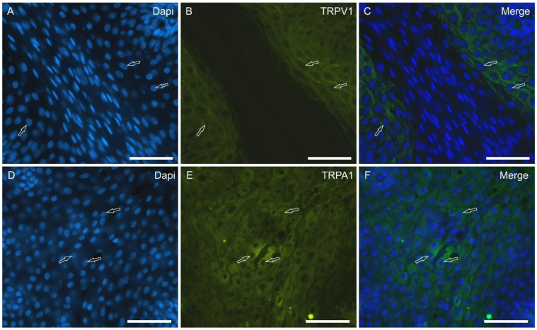 Photomicrographs showing tangential cryosections of the surface of the piglet tongue in which anti-TRPV1 and TRPA1 antibodies were applied. The arrows indicate the nuclei of some of the most superficial non-gustatory epithelial cells showing bright TRPV1 (for the most part on the cell membrane) (A–C) and TRPA1 (for the most part within the cytoplasm) (D–F) immunoreactivity (B); (C,F): merged images. Scale bar: 50 µm.