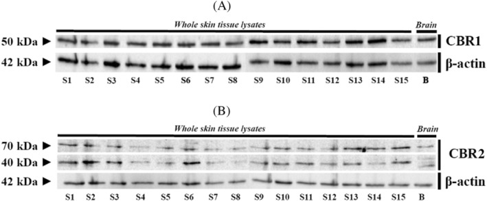 Western‐blot whole skin tissue protein expression for CBR1 (A) and CBR2 (B) in all equine samples and brain reference tissues