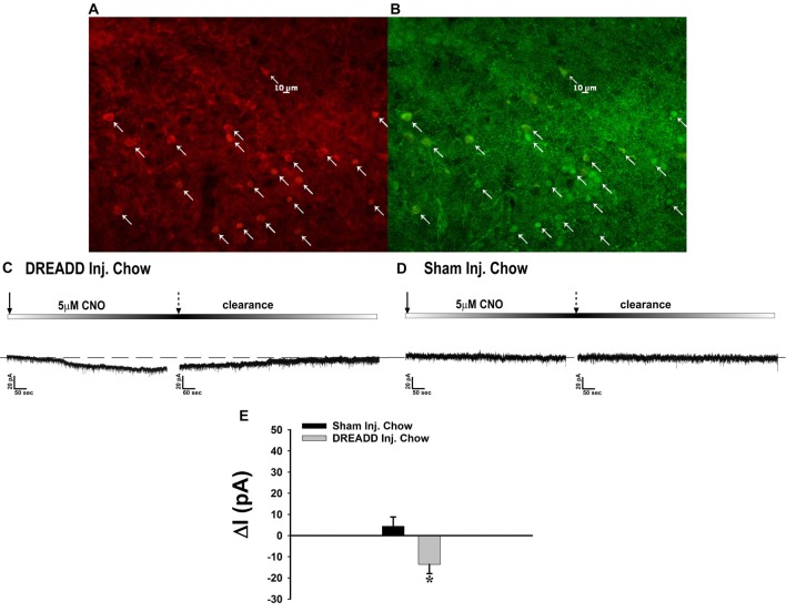 Chemostimulation of VMN SF-1 neurons in male NR5A1-cre mice reversibly stimulates POMC neurons in designer receptor exclusively activated by designer drugs (DREADD)-injected but not sham-injected animals. The color photomicrograph shows the expression of the Gq-M3-DREADD (visualized with mCherry, A) in SF-1 neurons (visualized with AF488, B). (C) Representative traces of membrane current showing that clozapine-N-oxide (CNO) (5 μM) induced a reversible inward current in identified POMC neurons from DREADD-injected animals (n = 13) that was altogether absent in cells from sham-injected animals (D; n = 4). The composite bar graph in (E) further illustrates the stimulatory effect of CNO in POMC neurons from DREADD-injected animals but not sham-injected animals. Bars represent means and lines 1 SEM of the CNO-induced change in membrane current. *P < 0.05; Student’s t-test.