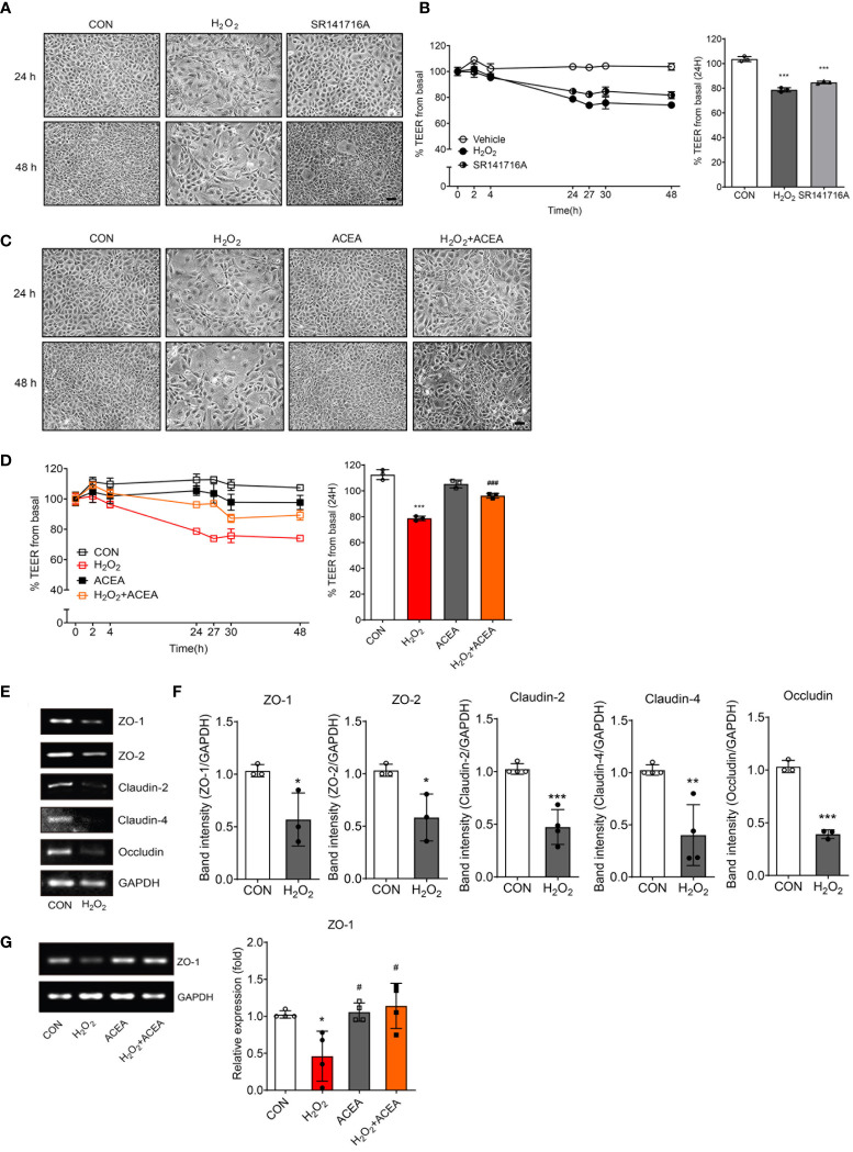 Intestinal permeability and tight junction protein expression were regulated by CB1 signaling modulation. (A) Morphological changes showed IEC-6 cell senescence by H2O2 and SR141716A treatment (n=5). Scale bar, 100 μm. (B) The TEER values were detected in H2O2-treated IEC-6 cells and cells treated with the CB1 inverse agonist SR141716A. The bar graph indicated the TEER values at 24 h (B, right). Statistical differences were determined using t-test; ***p<0.001 compared to control group. Error bars, SD (n=3). (C) Morphological changes showed IEC-6 cell senescence caused by H2O2 and the restoration of cell morphology with ACEA treatment after 24 h and 48 h (n=5). Scale bar, 100 μm. (D) The decreased TEER values caused by H2O2 treatment were increased by co-treatment with the CB1 agonist ACEA. The bar graph presents the TEER values at 24 h after treatment with H2O2 and ACEA (D, right). Statistical differences were determined using t-test; ***p<0.001 compared to control group and ###p<0.001 compared to H2O2-treated group. Error bars, SD (n=3). (E, F) The mRNA expression levels of the tight junction proteins ZO-1, ZO-2, Claudin-2, Claudin-4 and Occludin were detected by RT-PCR in H2O2-treated IEC-6 cells. RT-PCR results showed a decrease in the levels of these tight junction proteins (E) and the bar graph presents the band intensity of the RT-PCR results (F). Statistical differences were determined using t-test; *p<0.05, **p<0.01, and ***p<0.001 compared to control group. Error bars, SD (n = 3). GAPDH was used for the loading control. (G) Decreased RNA expression of ZO-1 by H2O2 was restored by ACEA co-treatment. The bar graphs present the band intensity of PCR results. Statistical differences were determined using t-test; *p<0.05 compared to control group and #p<0.05 compared to H2O2-treated group. Error bars, SD (n = 3).