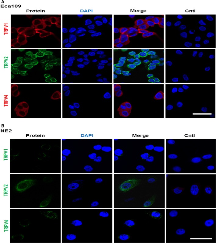 Localization of thermo‐TRPVs in nontumor esophageal squamous and ESCC cell lines. (A) The staining demonstrated that TRPV1 was expressed and mainly located in the plasma membrane of Eca109 (in red). TRPV‐2 and 4 were also found to be expressed and predominantly resided in the plasma membrane of Eca109 cells (TRPV2 in green; TRPV4 in red). DAPI was used to stain the DNA in the nucleus in all experiments (in blue). Eca109 cells which were omissive of primary antibody during the staining procedure were used as negative controls. (B) It showed that TRPV‐1, 2, and 4 were all expressed and mainly resided in the plasma membrane of NE2 (in green). NE2 cells which were omissive of primary antibody during the staining procedure were used as negative controls. Cntl: control. Bar = 10 μm.