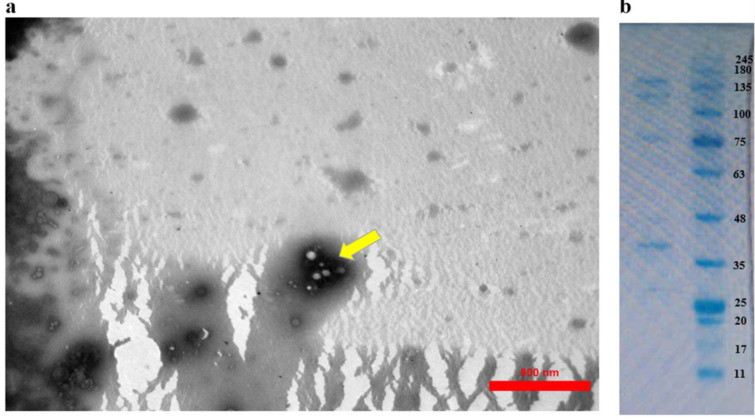 (a) Transmission electron microscopy: Spherical morphology of extracellular vesicles (scale bars, 800 nm), (b) The protein profile derived from Bacteroides thetaiotaomicron in sodium dodecyl sulfate polyacrylamide gel electrophoresis