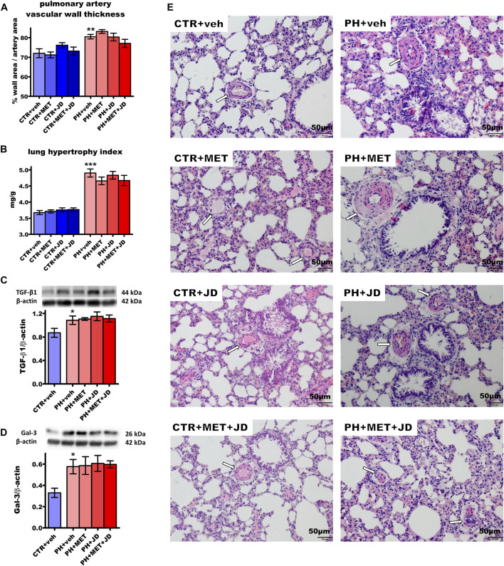 Influence of pulmonary hypertension, metformin (MET), JD5037 (JD) and/or their combination on pulmonary remodeling in monocrotaline-induced pulmonary hypertensive (PH) rats and their normotensive controls (CTR). (A) pulmonary artery vascular wall thickness, (B) lung hypertrophy index (expressed as lung weight to body weight) and expression of (C) transforming growth factor β1 (TGF-β1) and (D) galectin-3 (Gal-3) determined by Western blot (WB) technique, (E) representative hematoxylin and eosin-stained lung images (200x magnification). β-actin served as a loading control in WB. Arrows on images show the location of the vessels. MET (100 mg/kg), JD5037 (3 mg/kg) or their combination were administered by oral gavage once daily for 21 days; controls received vehicles (veh) instead. Data are expressed as mean ± SEM; n = 9–20 (A–B), n = 5 (C,D); *p < 0.05; **p < 0.01; ***p < 0.001 significantly different from CTR + veh.