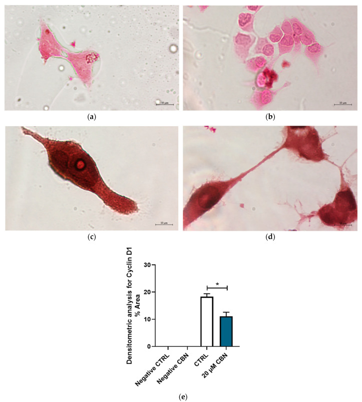 Immunocytochemistry analysis of differentiated NSC-34 cells. Untreated differentiated NSC-34 cells without primary antibody (Negative CTRL) (a), 20 µM CBN-treated differentiated NSC-34 cells without primary antibody (20 µM CBN Negative CTRL) (b), untreated differentiated NSC-34 cells immunoprofiled for Cyclin D1 (c), and 20 µM CBN-treated differentiated NSC-34 cells immunoprofiled for Cyclin D1 (d). Objective: 100×. Densitometric analysis for Cyclin D1 (e). The data represent the percentage of staining resulting from the immunohistochemistry analysis. We report the mean ± SEM of the samples. Statistical significance was evaluated by t test. * indicates a significant difference (p < 0.05) between Cyclin D1 expression level in 20 µM CBN compared to CTRL.