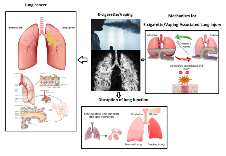 A schematic illustration of the possible effects of vaping or e-cig on the lungs and respiratory systemOriginal illustration, made by the author, F. Rahim
