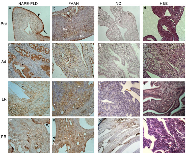 Representative images of tissue localization of NAPE-PLD and FAAH in mice uteri during reproductive aging. Representative images of NAPE-PLD (a,e,i,m) and FAAH (b,f,j,n) immunoreactivity in prepubertal (PrP), adult (Ad), late reproductive (LR), and post-reproductive (PR) mouse uteri. Negative controls (NC; (c,g,k,o)) and H&E staining (d,h,l,p) are also presented. Annotations and abbreviations—Arrows: perimetrium; arrowheads: columnar epithelium; asterisks: glands; My: myometrium; Mu: mucinous compartment; S: stroma. Scale bar: 50 µm. Magnification: ×200.