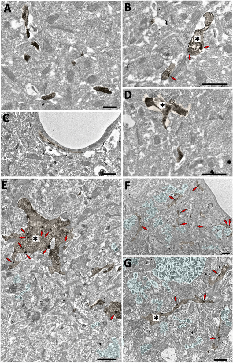 Microglial GFP localization in the subiculum of CB2 EGFP/f/f and 5xFAD/CB2 EGFP/f/f mice. Double pre-embedding immunogold (GFP) and immunoperoxidase (Iba1) method for electron microscopy. GFP particles (red arrows) localize in Iba1-positive microglial elements (DAB immunodeposits, brown, *). In CB2 EGFP/f/f (A–D), only GFP membrane localization is observed (arrows, (B). In 5xFAD/CB2 EGFP/f/f, GFP particles are found in both membranes and cytosol (E–G). Notice dystrophic neurites (light green areas contoured by white dashed lines) in 5xFAD/CB2 EGFP/f/f. Scale bars: 1 µm.