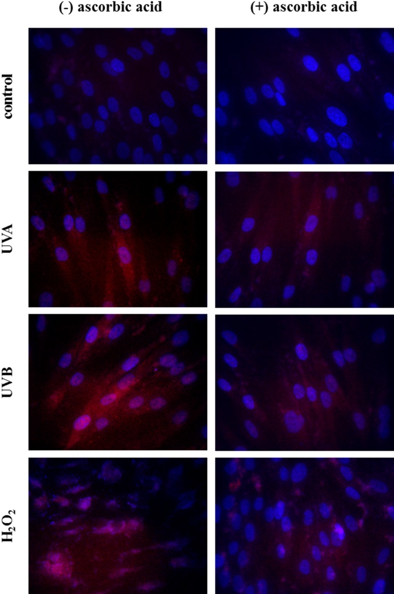 The cytoplasmic and nucleus level of Nrf2 in fibroblasts control cells and after exposure of UVA (20 J/cm2), UVB radiation (200 mJ/cm2), H2O2 (200 µM), and ascorbic acid (100 µM) (blue nucleus; red Nrf2)