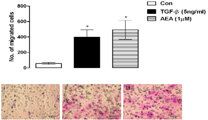 MSCs migrate towards the endocannabinoid anandamide. TGF-β (5 ng/mL; 48 hours) induced a significant increase in the migration of MSCs as assessed by the Boyden chamber cell migration assay compared to the number of MSCs that migrated to control media (Con; *p < 0.05, 1-way ANOVA and Newman-Keuls, n = 3). Migration of MSCs was also induced by anandamide (AEA; 1 μM, 48 hours) compared to control (Con; *p < 0.05, 1-way ANOVA and Newman-Keuls, n = 3). Inset: images of MSCs that migrated towards (i) control media; (ii) TGF-β (5 ng/mL; 48 hours) and (iii) AEA (1 μM, 48 hours).
