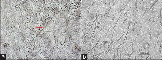 Upper epidermis (a), lower epidermis (b)