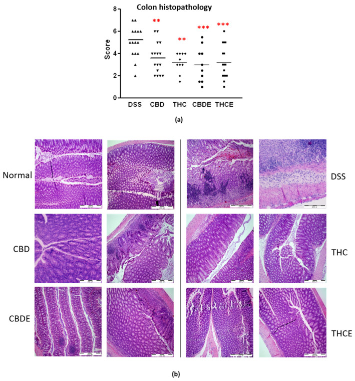 Histopathology of the colons of DSS model mice. Paraffin sections were stained with H&E and scored for inflammation and tissue damage; (a) Summary of average scores. p-value as compare with the DSS control group **, <0.01; ***, <0.001; (b) representative pictures of H&E stained sections. DSS—dextran sodium sulfate; THC—D9 tetrahydrocannabinol; CBD—cannabidiol; THCE—high THC cannabis extract; CBDE—high CBD cannabis extract.