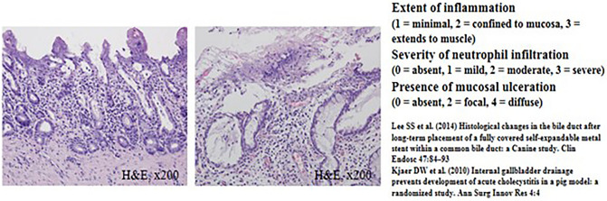 Comparison of microscopic images of bile duct inflammation using histologic scoring system between 1-month (left) and 3-month (right) follow-up animal models.