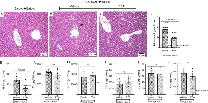 Treatment with PEA reduced damage and TNF‐α levels in the liver of mice subjected to GVHD. H&E‐stained slices of liver from the syngeneic group, and from allogeneic recipient mice treated with vehicle or PEA were examined (A–C). The → indicates inflammatory infiltrate. (D) Histopathological scores of the groups were then compared. The concentrations of cytokines and chemokines were evaluated (E) TNF‐α, (F) IFN‐γ, (G) IL‐10, (H) CCL2, (I) CCL3 and (J) CCL5. Treatment was performed from Day 0 until the end of the experiment. Groups were considered significantly different when p < 0.05, compared to the allogeneic group. Assessed by unpaired parametric two‐tailed Student's t test (n = 9 for the histopathological score n = 5 for the quantification of Inflammatory mediators). The N for the histopathological score was result of two experiments.