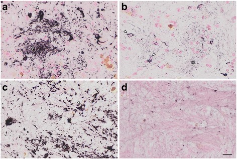 Tau-positive oligodendroglia-like cells and threads in the globus pallidus. In the globus pallidus of the 36 yo monkey, small oligodendroglia-like cells (arrowheads) and threads (asterisks) were positive with AT8 a. Argyrophilia with Gallyas silver impregnation was also observed b. Adjacent slices were positive with RD4 c but negative with RD3 d. Extended focus imaging (a–d, see legend of Fig. 1), Scale bar, 20 μm
