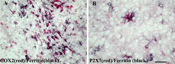 Co-localisation studies of COX-2 and P2X7 in MS spinal cord. Double staining of COX-2 or P2X7 cells with the microglia marker ferritin in MS spinal cord. Sections were incubated with mixture of A) Ferritin (black) and COX-2 (red) antibodies or B) ferritin (black) and P2X7 (red). The majority of COX-2 or P2X7 immunoreactive cells appear to be microglial cells/macrophages. Scale bar = 100 μm.