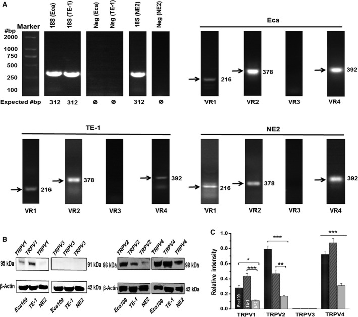 The mRNA and protein expression of thermo‐TRPVs in nontumor esophageal squamous and ESCC cell lines. (A) mRNA of TRPV1, TRPV2, and TRPV4 were detectable in all three cell lines, whereas TRPV3 was absent. (B) Western blot bands for TRPV1 (95 kDa), TRPV2 (86 kDa) and TRPV4 (98 kDa) were present in Eca109, TE‐1, and NE2 cells. β‐actin (42 kDa) staining was used to confirm that an equal amount of protein was loaded in each lane and normalize the densitometric results (in C). (C) Densitometric quantification of TRPV‐1, 2, 3, and 4 protein among three cell lines. Experiments were conducted at least in triplicate. Data were relative to β‐actin and represent the mean ± SEM of the indicated TRPV relative protein expression. Eca, Eca109; VR, TRPV; Neg, negative; *P < 0.05, **P < 0.01, ***P < 0.001.