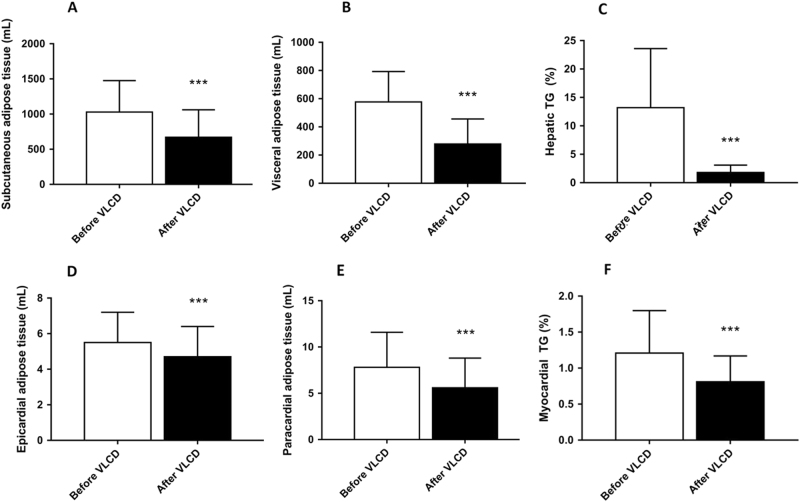 Volumes of various adipose tissue compartments before and after VLCDChange in SAT volume (a), VAT volume (b), hepatic TG content (c), epicardial adipose tissue volume (d), paracardial adipose tissue (e) and myocardial TG content (n = 22) (f). Results are expressed as mean ± SD. *** p < 0.001 vs. before VLCD, n = 27, except for F, n = 22