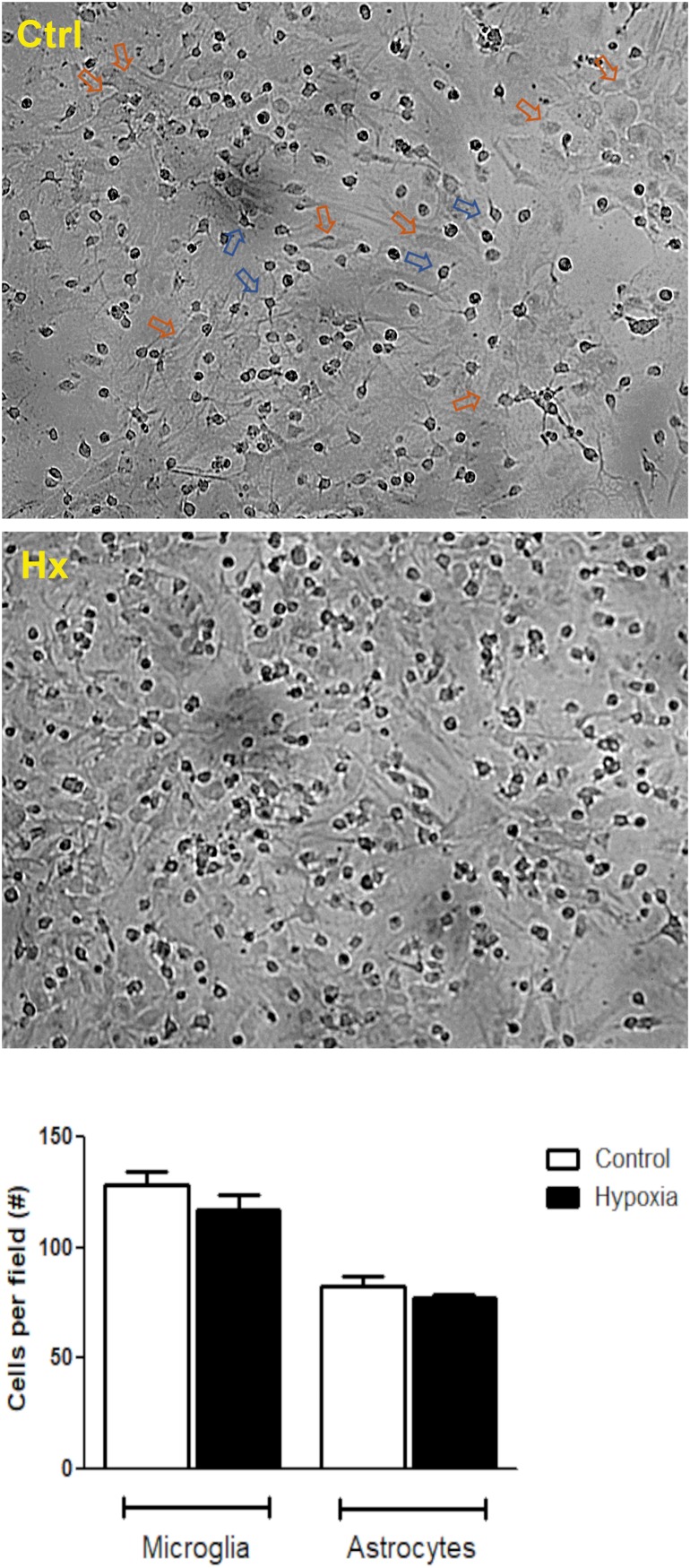 Hypoxia effect on glial mixed culture. Representative phase contrast images showing glial mixed culture. Morphological differences between microglia and astrocytes are indicated by blue or orange arrows, respectively. Glial mixed cultures exposed to control conditions (DMEM, upper image) or chemical CoCl2-induced hypoxia (bottom image). Images were acquired at total magnification of 40×.