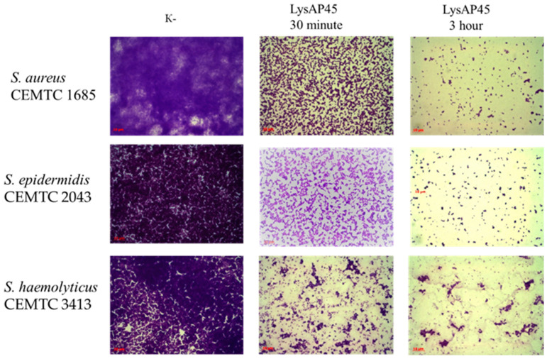 Biofilm disruption activity assay for the recombinant protein LysAP45 against biofilms formed by S. aureus CEMTC 1685, S. epidermidis CEMTC 2043, and S. haemolyticus CEMTC 3413. Bacterial cells were stained with methylene blue. The fields with the maximum and minimum number of cells after incubation with LysAP45 are shown.