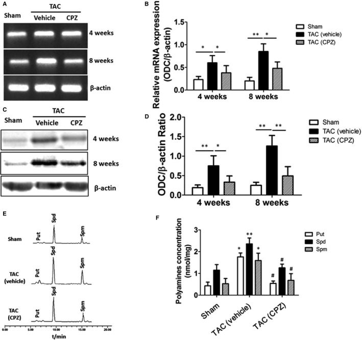 Expression of ODC and polyamine levels were downregulated in CPZ‐treated TAC‐operated mice. A, Expression of ODC mRNA in left ventricle tissue collected from vehicle control‐ and CPZ‐treated mice at 4 or 8 weeks after sham or TAC operation is shown. B, Analyses of cardiac ODC mRNA levels in the above groups (n=6 mice per group) are shown. *P<0.05, **P<0.01. C, Western blotting results from left ventricle tissue of the vehicle control‐ and CPZ‐treated mice at 4 or 8 weeks after sham or TAC operation are shown. D, Analyses of ODC protein in the above groups (n=6 mice per group) are shown. *P<0.05, **P<0.01. E, Representative figure shows the chromatographic separation of polyamines including putrescine, spermidine, and spermine in left ventricle tissue of the sham‐operated and vehicle control‐ and CPZ‐treated TAC‐operated mice. F, Measurement of polyamine level in the above group (n=6 mice per group) is shown. *P<0.05, **P<0.01 versus sham group, # P<0.05 versus TAC vehicle control group. CPZ indicates capsazepine; ODC, ornithine decarboxylase; Put, putrescine; Spd, spermidine; Spm, spermine; TAC, transverse aorta constriction.
