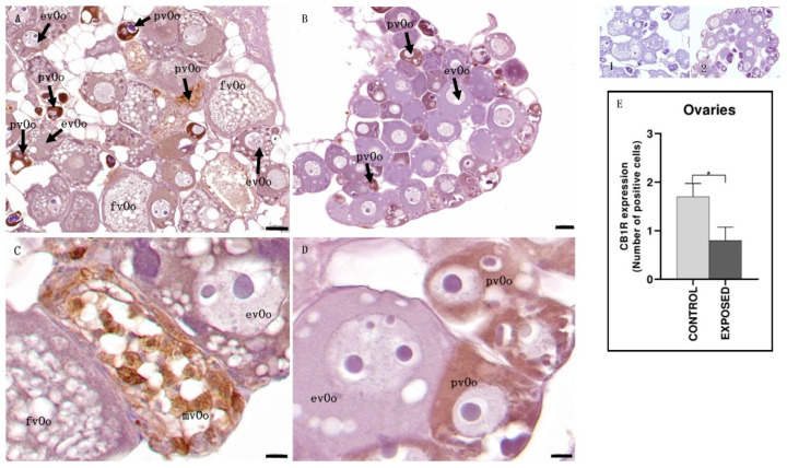 Light micrographs of eel ovary. Immunoreactivity to CB1R. (A,C): control specimens; (B,D): exposed specimens. Insets: 1, 2: negative control of (A,B), respectively. In control specimens (A,C), CB1R signaling was mainly observed in previtellogenic (pvOo) oocytes and mid-vitellogenic oocytes (mvOo), with no immunopositivity detected in early vitellogenesis (evOo) or full vitellogenesis (fvOo) oocytes. In contrast, the exposed specimens (B,D) showed immunoreactivity to CB1R only in previtellogenic oocytes (pvOo), while early vitellogenic oocytes (evOo) remained negative. Scale bar: (A,B): 0.050 mm; (C,D): 0.010 mm. (E): semi-quantitative analysis of immunoreactivity. The Mann–Whitney test showed a statistically significant difference among the control and the exposed specimens. * p < 0.05 (0.0286).