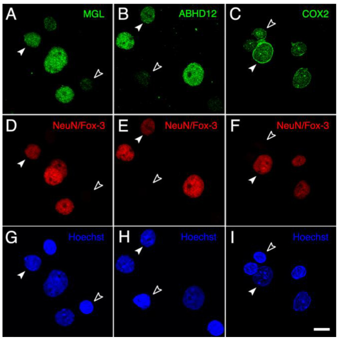 Panoramic micrographs of intact nuclei isolated from the adult rat brain cortex processed for MGL-, ABHD12- and COX2-immunofluorescence (A–C) combined with NeuN/Fox-3-immunofluorescence (D–F) and Hoechst’s chromatin staining (G–I). Every NeuN-positive nucleus exhibited strong immunoreactivity for MGL, ABHD12 and COX2 (filled arrowheads), whereas NeuN-negative nuclei (empty arrowheads) displayed clear positive staining only for COX2. All micrographs were acquired in grayscale and pseudo colored. Scale bar = 20 µm in I (applies to (A–I)).