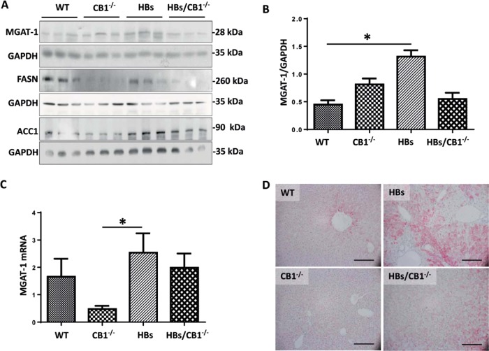 CB1 knockout induced suppression of lipogenesis in HBs transgenic mice. a Western blot analysis of liver lysates of 52-week-old mice was performed using specific anti-MGAT1, anti-FASN, and anti-ACC1 antibodies. Equal protein loading was controlled by anti-GAPDH and anti-β-actin antibodies, respectively. b Bar graph representing normalized MGAT1 protein expression to GAPDH. Statistic, one-way ANOVA, Kruskal–Wallis test (P = 0.004), Dunnet’s multiple comparison test were performed. c Quantitative real-time PCR (qRT-PCR) analysis of MGAT1 transcript was performed. The amount of RNA in the different samples is normalized to β-actin as reference gene and shown as relative expression (ΔΔCt). Statistical analysis was performed in GraphPad, One-way ANOVA (Kruskal–Wallis test, P = 0.0053). Dunn’s multiple comparison test was used to compare among different group. d Representative immunohistochemistry of paraffin section using specific DGAT1 antibody. Magnification, ×200 bar 200 µm