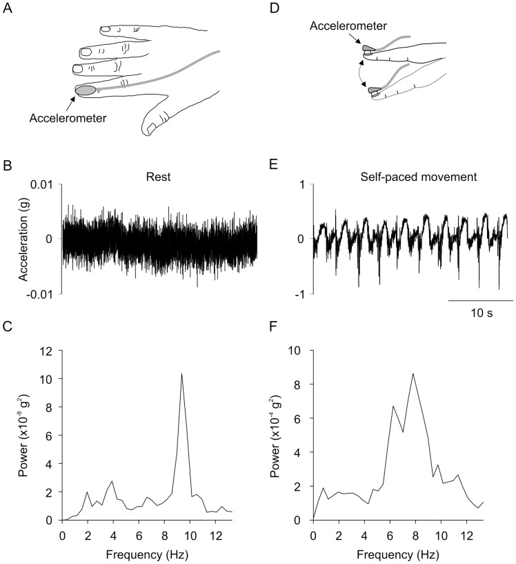 Experimental apparatus and acceleration traces from one subject.A) Experimental apparatus. B) Raw acceleration trace during relaxation. C) Result of the fast Fourier transform during relaxation. D) Flexion and extension of the index finger with the accelerometer attached. E) Raw acceleration trace during self-paced movement. F) Result of the fast Fourier transform during self-paced movement.