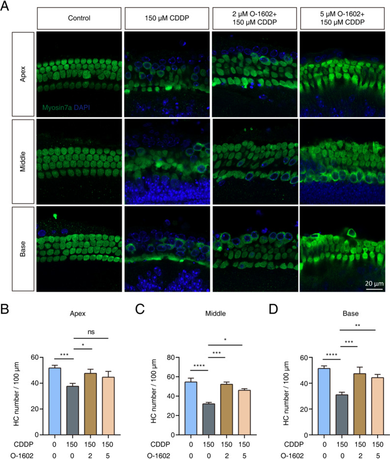 O-1602 improved the survival of HCs after exposure to CDDP. (A) Representative images from immunofluorescence staining showed Myosin7a (green) labeling HCs in the apical, middle, and basal turns across four experimental groups. Cochlear explants were pretreated with either 2 or 5 µM O-1602 for 2 h before receiving 150 µM CDDP for 24 h. (B-D) Quantification of Myosin7a-positive cell numbers was performed in the apical, middle, and basal turns, respectively. HC: hair cell.
