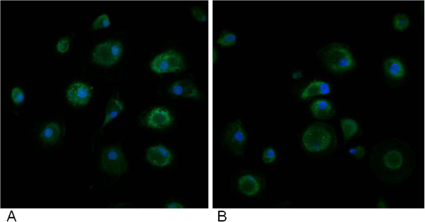 Representative quantitative fluorescent confocal-photomicrograph of blood monocyte-derived macrophages (BMDMs) from autistic patients showing immunocytochemistry (green fluorescent) for Ki67 marker. To correctly identify cells, their nuclei were counterstained with bisbenzimide (blue fluorescence). (A) untreated BMDMs; (B) Gc-MAF treated BMDMs.