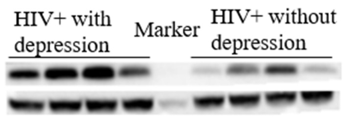 Representative image of protein levels of NUCB1. Western blotting results showed that in HIV-infected individuals, having comorbid depression significantly increased the expression of NUCB1 in the cerebrospinal fluid.