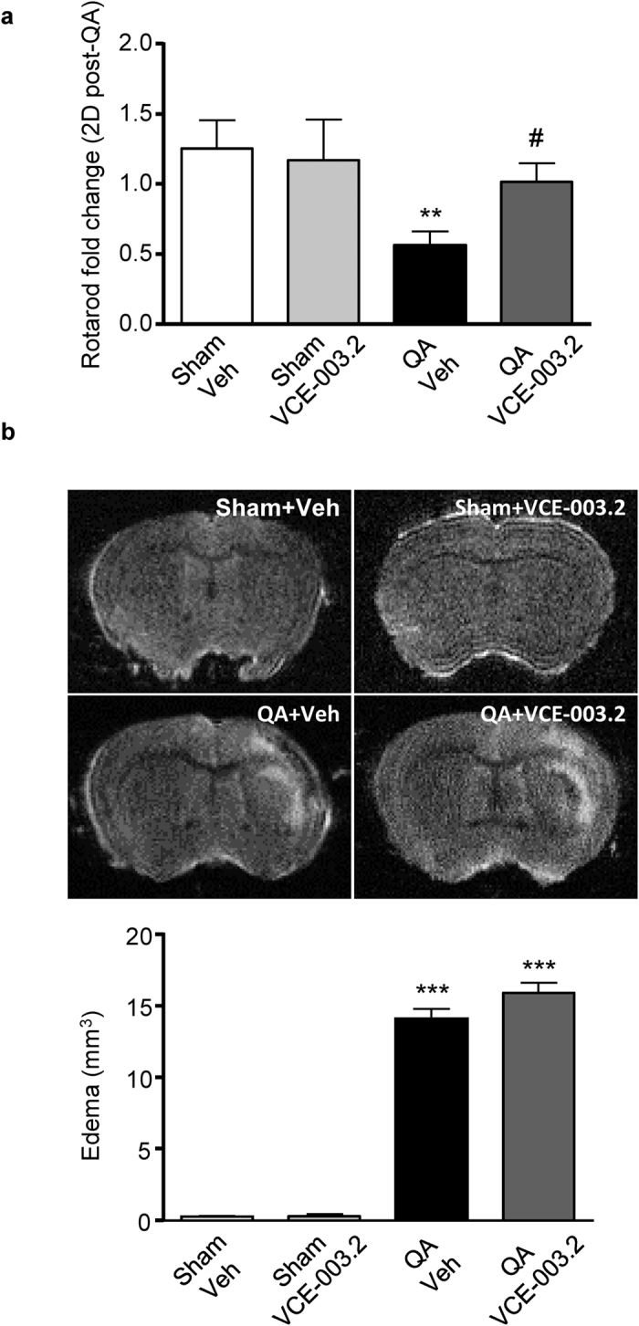 Protective action of VCE-003.2 administration in QA-induced excitotoxicity in vivo.(a) CD1 mice were subjected to quinolinic acid (QA) intrastriatal injection and RotaRod performance (fold change) was determined 2 days after lesion in vehicle- and VCE-003.2-treated mice (10 mg/kg). (b) Representative MRI images (Upper panel) and edema volume quantification (lower panel) 5 days after QA injection. Values are expressed as means ± SEM. Sham-Veh and Sham-VCE (n = 7 in each group); QA-Veh (n = 8); QA-VCE (n = 7). **p < 0.01, ***p < 0.001 vs. Vehicle. #p < 0.05 vs. QA.