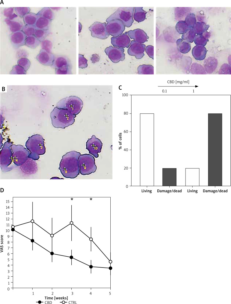 U 937 cells (promonocytic cell line) were cultured alone or with increasing doses of CBD for 48 h, harvested, spun on microscope slides, and stained with the May-Grunwald and Giemsa method (A). Untreated cells, cells (CTRL)/control cells or those treated with 0.1 and 1 mg/ml CBD (from the upper left panel, clockwise). Methodology used for the quantification of damaged cells (B). Quantification of damaged cells (C). Clinical efficacy of the CBD-containing preparation (cleansing cream) was observed, with a statistically significant decrease noted in the CBD-treated group compared to the control group over a 5-week period (D)
