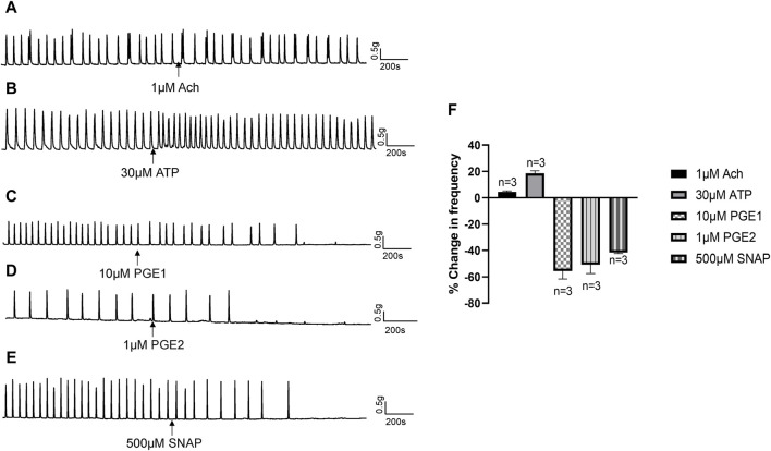 Effects of neurotransmitters released from urothelium on human ureteral contractions. (A–E) Representative traces showing that acetylcholine [Ach 1 μM; (A)] exerts no obvious effects while ATP [30 μM; (B)] produces an excitatory effect on ureteral contractions. PGE1 [10 μM; (C)], PGE2 [1 μM; (D)] and SNAP [500 μM; (E)] significantly reduced the frequency of ureteral contractions. (F) Summary data on the effects of neurotransmitters. Drug effects are expressed as % change in the frequency (Hz) from the baseline. n: the number of strips. Ach, acetylcholine; SNAP, S-Nitroso-N-acetyl-DL-penicillamine.