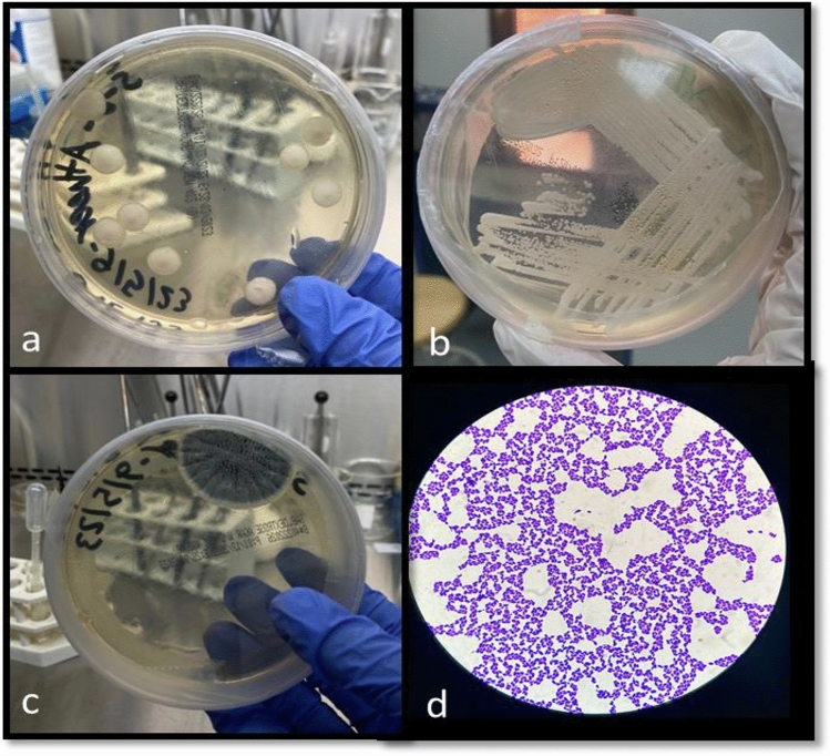 (a,b) Positive growth of fungi on Sabouraud dextrose agar (SDA). (c) A growth of mold. (d) Microscopic view of yeast with crystal violet stain shows small oval-shaped cells with budding.