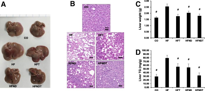 Changes of liver after 8-week training and/or dietary change. Changes in liver size (a), lipid droplet (b), liver weight (c), and liver triglyceride (d) after treadmill training. Data are expressed as mean ± SE. CO, normal-diet group; HF, high-fat diet group; HFT, high-fat diet + training group; HFND, dietary change to a normal diet + sedentary group; HFNDT, dietary change to a normal diet + training group. # versus HF group, p < 0.05. Scale bar = 50 μm