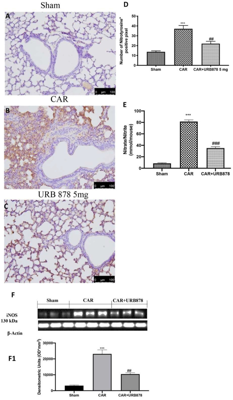Effect of URB878 on nitrosative stress. Sham (A); CAR (B); CAR+URB878 5 mg/kg (C); graphical analysis (D) for nitrotyrosine. Nitrite/nitrate levels (E); Western Blot for iNOS expression (F); densitometric analysis (F1); Scale bar for (A–C) was 100 μm; Values are means ± SEM of 6 mice for all groups. Photos shown are representative of the results obtained. See manuscript for further details. *** p < 0.001 vs. sham; ## p < 0.01 vs. CAR; ### p < 0.001 vs. CAR.