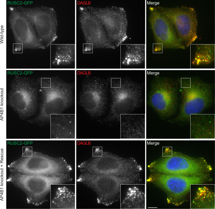 Overexpression of the AP-4 vesicle transport adaptor RUSC2 drives DAGLB to the cell periphery.Widefield imaging of HeLa cells stably expressing RUSC2-GFP (green), labelled with anti-DAGLB (red). Top panel, wild-type; middle panel, AP4B1 knockout; lower panel, AP4B1 knockout with transient expression of AP4B1 (rescue). In the merged image, DAPI labelling of the nucleus is also shown (blue). The insets show accumulation of RUSC2-GFP-positive and DAGLB-positive puncta at the cell periphery, and this only occurred in the presence of AP-4 (wild-type and rescue). Images are representative of at least 20 images per condition, including three independent rescue transfections. Immunofluorescence and microscopy were performed independently from two technical replicates of separate coverslips from the same batch of cells. Consistent results were observed for cells expressing RUSC2 with an N-terminal GFP tag and with AP4E1 knockout (data available at https://zenodo.org/record/5696988). Scale bar: 10 µm.