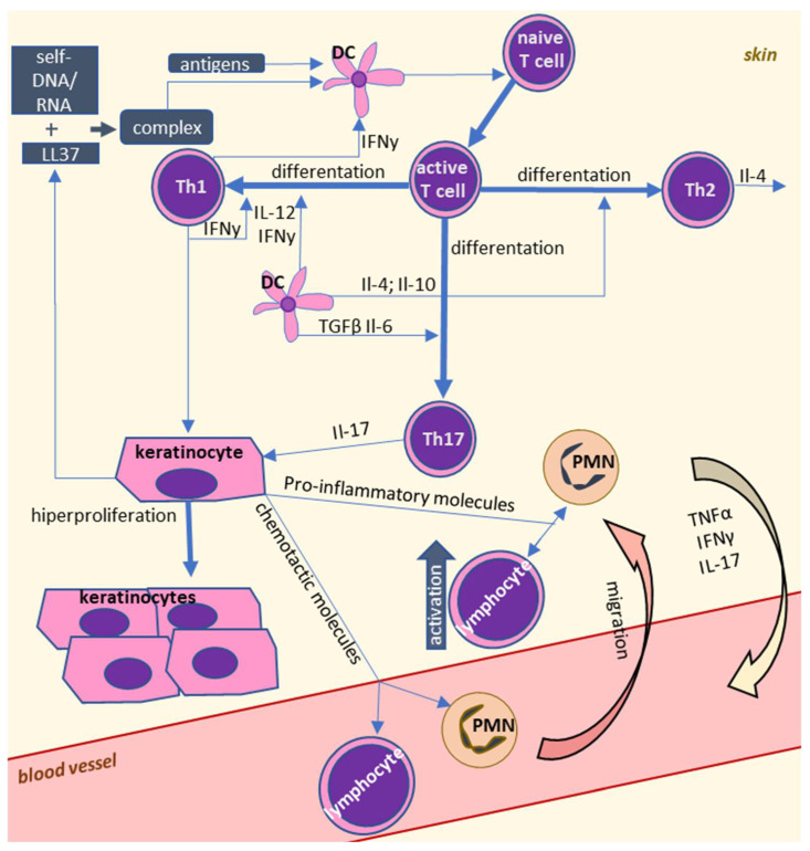 Cellular interactions in psoriasis. Psoriasis is characterized by abnormal interactions between leukocytes. Overactivation of dendritic cells leads to polarization of T lymphocytes into T helper 1 (Th1) and in consequence higher levels of pro-inflammatory factors produced by these cells, which cause proliferation of keratinocytes. Activation of granulocytes during psoriasis is important for the progression of inflammation and oxidative stress.