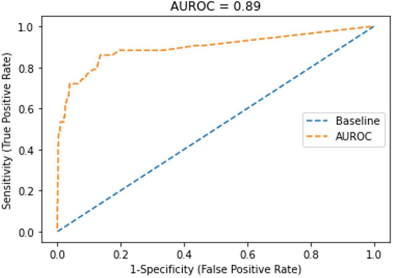 Receiver Operating Characteristic curve of the random forest model.