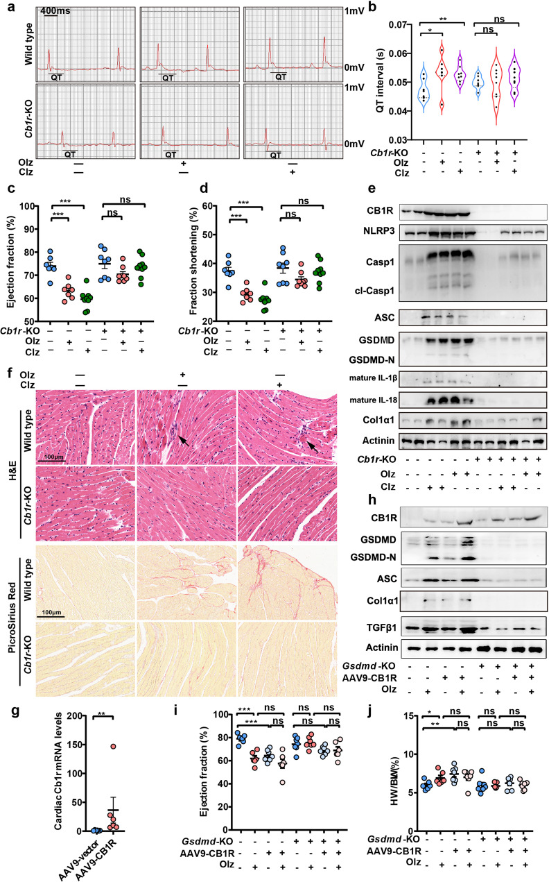 Genetic knockout of Cb1r alleviated antipsychotics-induced pyroptosis and cardiotoxicity. a, b Electrocardiography (ECG) monitoring of mice (n = 7–9 mice/group). c, d Echocardiography assessment of left-ventricle function of mice (n = 7–9 mice/group). e Western blot analysis of CB1R, NLRP3 inflammsome, and pro-fibrotic factors expression. f Histological analyses of hearts from each group of mice. Arrows indicated inflammatory infiltrate and hypereosinophilia of cardiomyocytes. Scale bar = 100 μm. g qRT-PCR analysis of the efficacy of cardiac overexpression of Cb1r using the AAV9 system (n = 6/group). h Western blot analysis of pyroptosis proteins and pro-fibrotic factors in WT and Gsdmd−/− mice receiving indicated treatments. i, j Ejection fraction was detected and heart weight (HW) was measured for the indicated treatments. All quantification represents the mean and SEM of each group. Unpaired Student’s t-test was used for analysis in (g). Two-way ANOVA was used for analysis in (b–d, i, j). ns, no significance. *p < 0.05; **p < 0.01; ***p < 0.001 as indicated