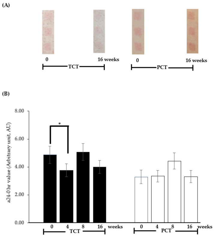 Sample photos of the redness level on the UV-exposed skin areas of the participants’ backs 24 h after radiation at 0 and 16 weeks post-administration of the tested chewable tablet (TCT) and placebo chewable tablet (PCT) (A). The mean ± SEM of the a24-0 h values (arbitrary units, AU) on the UV-irradiated skin area of participants receiving TCT (dark bar) or PCT (light bar) over 0, 4, 8, and 16 weeks is shown in (B). * p < 0.05, paired two-tailed t-test, compared to the 0-week baseline within each respective group.