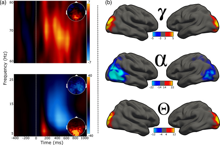 Neural responses serving visuospatial processing. (a): Spectrograms showing the three oscillatory responses identified at the MEG sensor level. Time (in ms) is denoted on the x‐axes, with 0 ms defined as the onset of the visual stimulus, and frequency (in Hz) is shown on the y‐axes. The lower spectrogram shows the theta (4–8 Hz, 25–275 ms) and alpha (8–14 Hz, 200–600 ms) responses, while the upper spectrogram shows the gamma (68–74 Hz, 200–600 ms) response. Insets show 2D power topographies of each oscillatory response grand‐averaged across the time–frequency windows of interest. (b): Activity from volumetric source images projected to the surface for visualization. Rows from top to bottom represent neural responses within the time and spectral windows of interest (i.e., gamma, alpha, theta). The color scale bars for spectrograms and 2D topographies (to the right of each plot), and for source maps (bottom of each plot) for each response reflects baseline‐normalized changes in power from the pre‐stimulus period