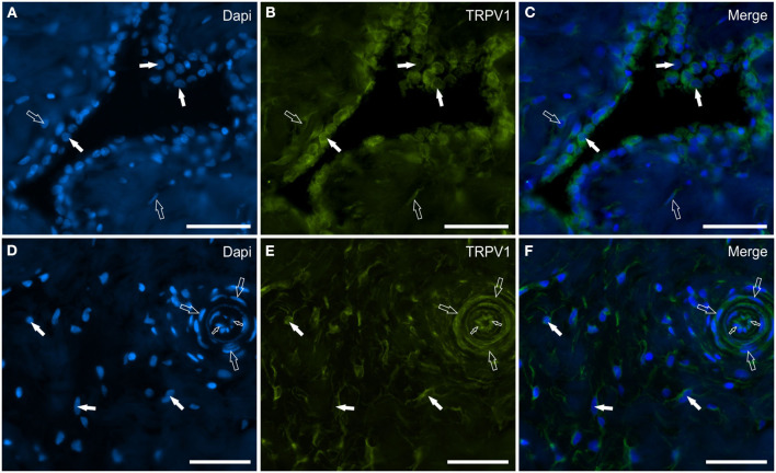 Photomicrographs of the cryosections of the synovial membrane of a horse metacarpophalangeal joint showing transient receptor potential vanilloid 1 (TRPV1) (B, E), immunoreactivity in synoviocytes (A–C), and fibroblast and vascular cells (D–F). (A–C) The white arrows indicate the DAPI (Blue) labeled nuclei of some round synoviocytes expressing bright TRPV1 (Green) immunoreactivity. The open arrows indicate subintimal cells (likely fibroblasts) showing faint-to-moderate TRPV1 immunoreactivity. (D–F) The open arrows indicate the DAPI (Blue) labeled nuclei of some cells of the interstitial connective tissues of the synovial membrane (close to the subintima) expressing moderate-to-bright TRPV1 (Green) immunoreactivity. The open arrows and the small open arrows indicate the DAPI labeled nuclei of the vascular smooth muscle cells and endothelial cells, respectively, expressing moderate TRPV1 immunoreactivity. (C, F) Merged images. Scale bar = 50 μm.