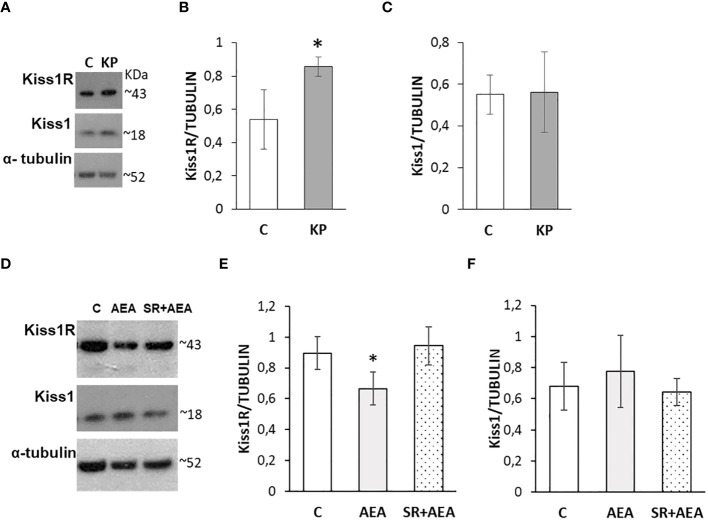 Modulation of the KS by KP (A–C) and AEA (D–F) in rat testis. Representative Western blots for Kiss1R and Kiss1 (A, D) and normalization of Kiss1R (B, E) and Kiss1 signals (C, F) carried out against α-tubulin. N = 6 different animals in KP treatments and n = 4 in AEA treatments; data are expressed as protein OD/tubulin OD ± standard deviation. C, control group (placebo-injected animals); KP, animals injected with Kp10; AEA, animals injected with AEA; SR + AEA, animals first received SR141716A and 30 min later received AEA treatment. *p< 0.05.