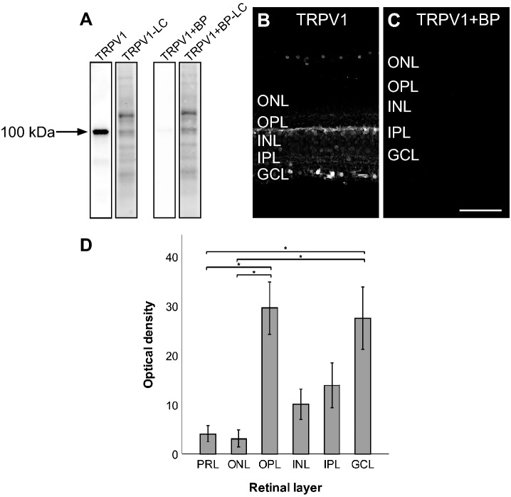 Characterization of the TRPV1 antibody in the monkey retina. Western blot analysis of total protein samples from a vervet monkey retina, showing detection of the expected protein band at 100 kDa (A). The band was not detected when the antibody was pre-incubated with its corresponding TRPV1 blocking peptide (BP) at the ratio 1:10 (A). All lanes contained 10 μg of total protein. Immunohistochemistry on vervet retinal tissue with the antibody raised against TRPV1 revealed a unique staining profile (B). When the TRPV1 antibody was pre-incubated with its corresponding BP, it revealed an absence of staining in the vervet retinas (C). Quantitative analysis of the TRPV1 fluorescent signal through the six different retinal layers reveals a relatively higher signal intensity in the OPL and the GCL layers compared to the photoreceptor (PRL) and the outer nuclear (ONL) layers (P < 0.05) (D). TRPV1 transient receptor potential vanilloid type 1, BP blocking peptide, LC loading control, PRL photoreceptor layer, ONL outer nuclear layer, OPL outer plexiform layer, INL inner nuclear layer, IPL inner plexiform layer, GCL ganglion cell layer. Scale bar = 75 μm. Mean optical density ratios ± standard error of the mean (SEM) are depicted.